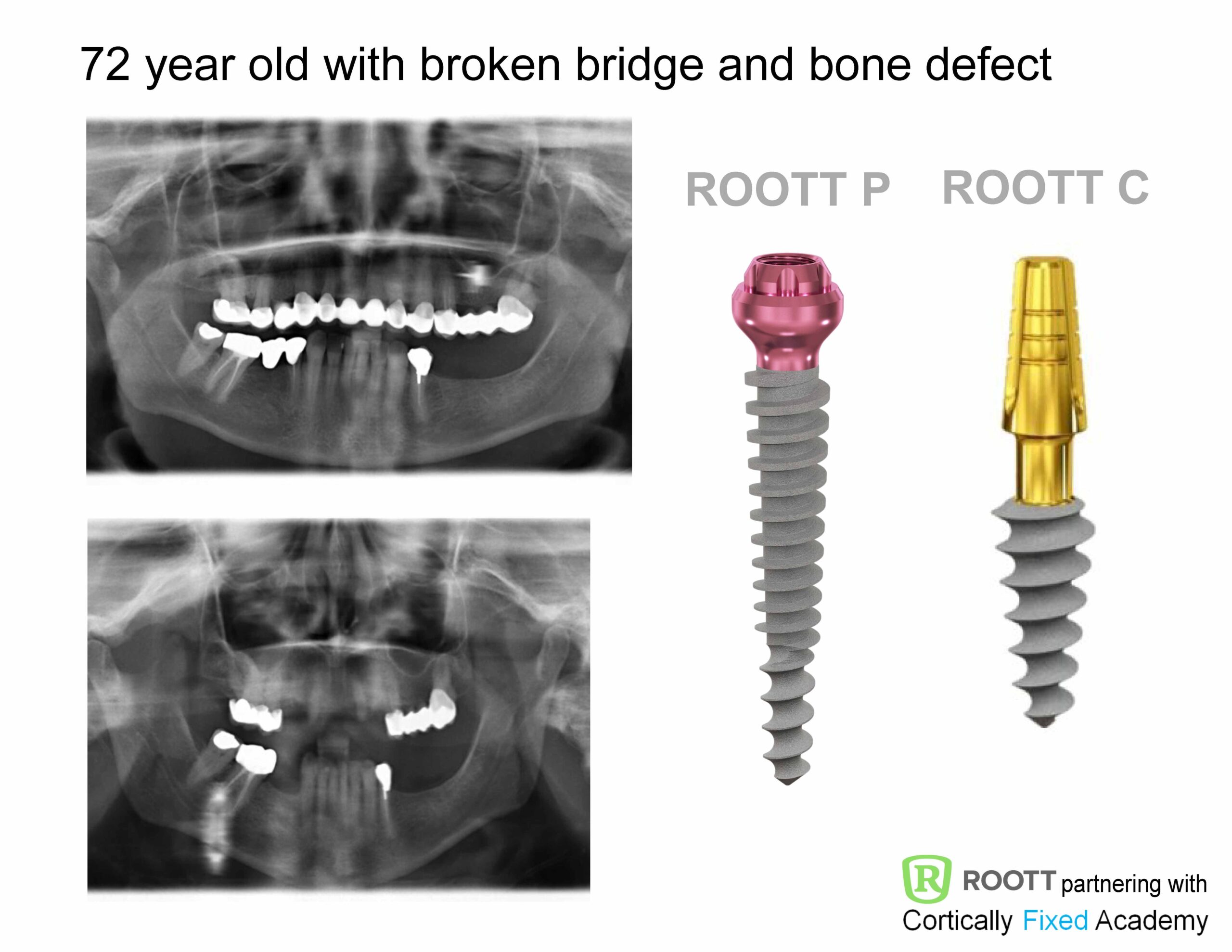 Minimal Invasive