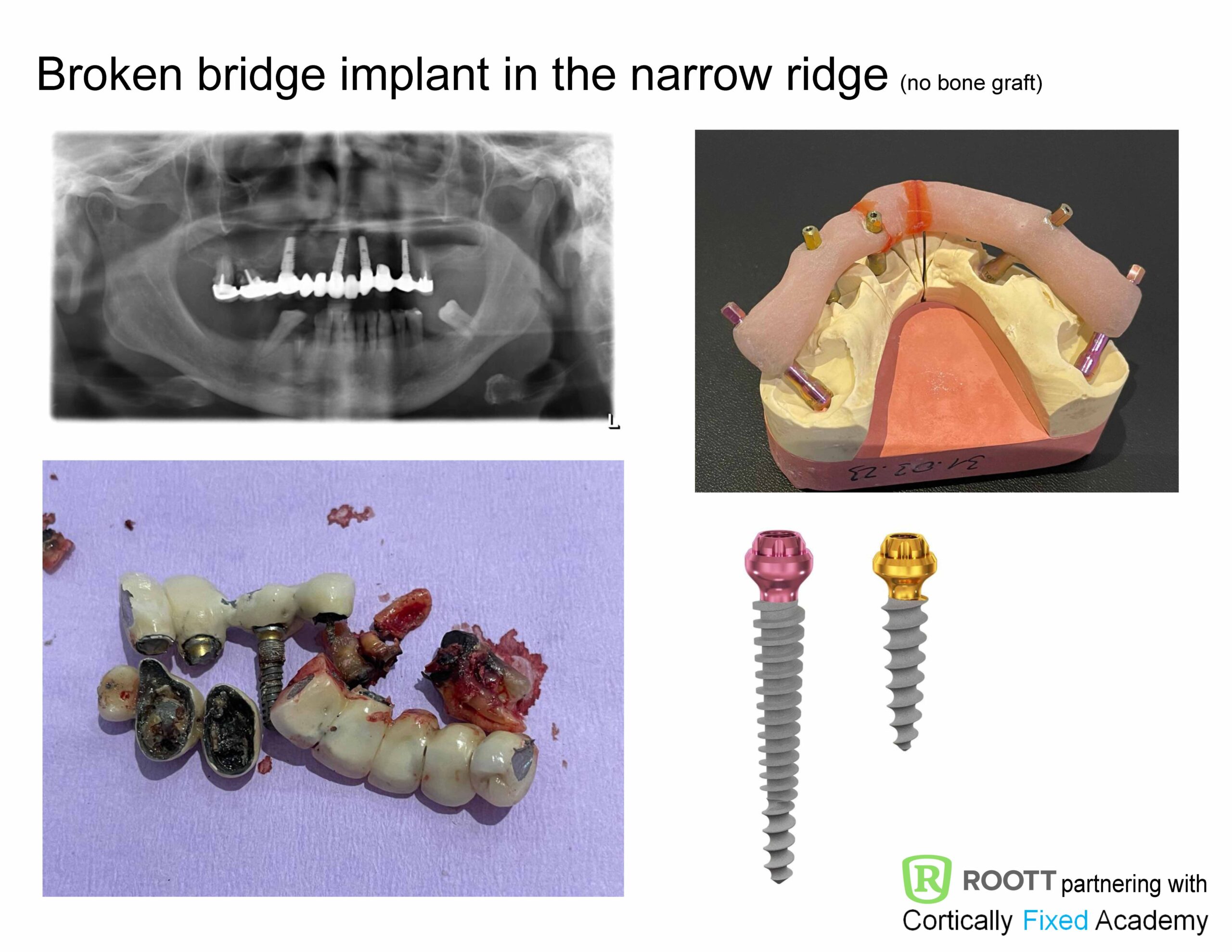 Minimal Invasive