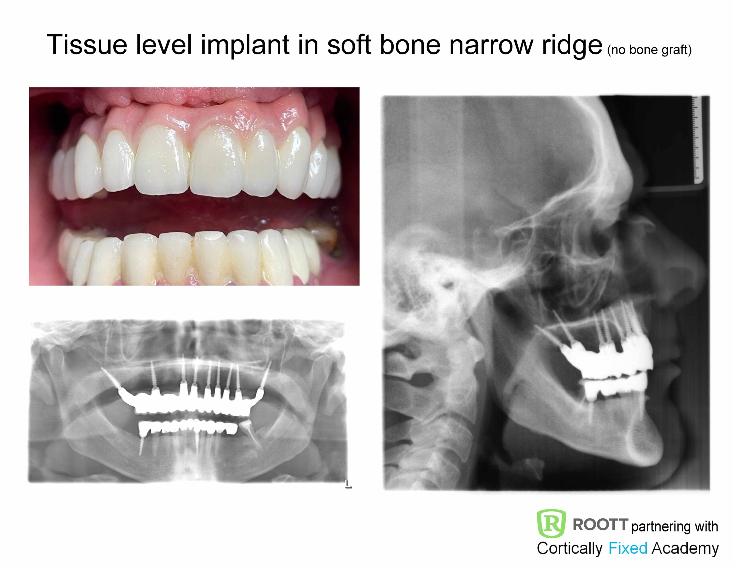 Minimal Invasive