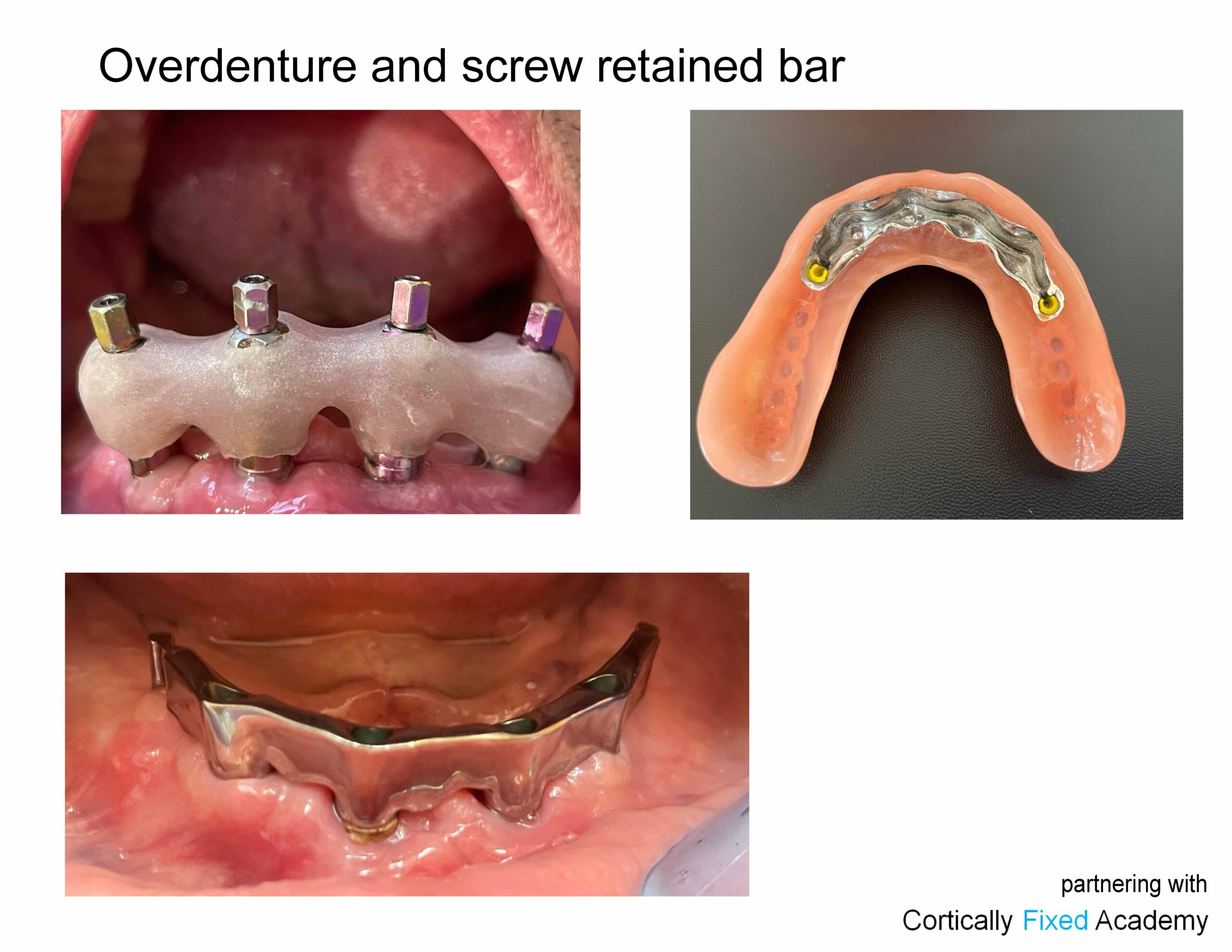 Minimal Invasive