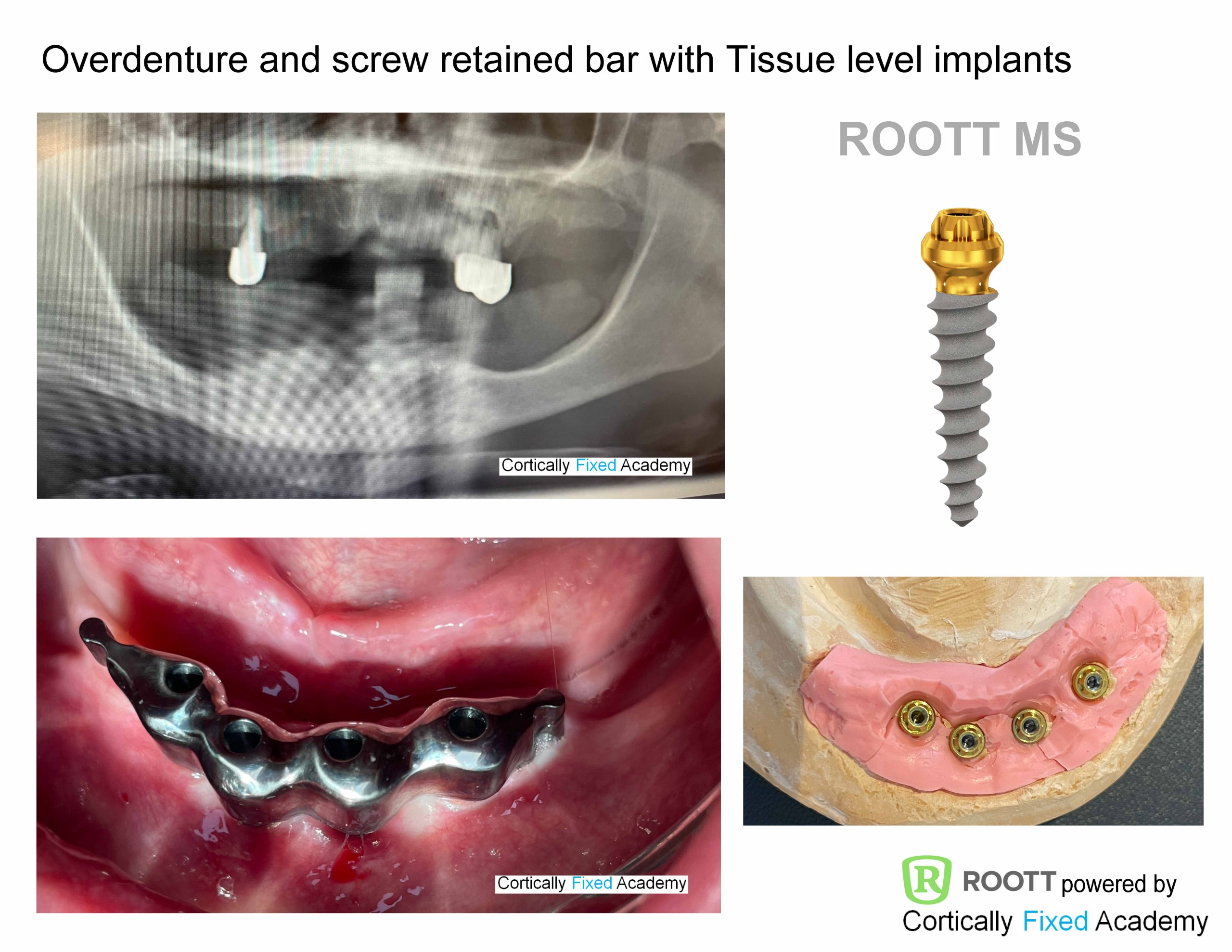 Minimal Invasive