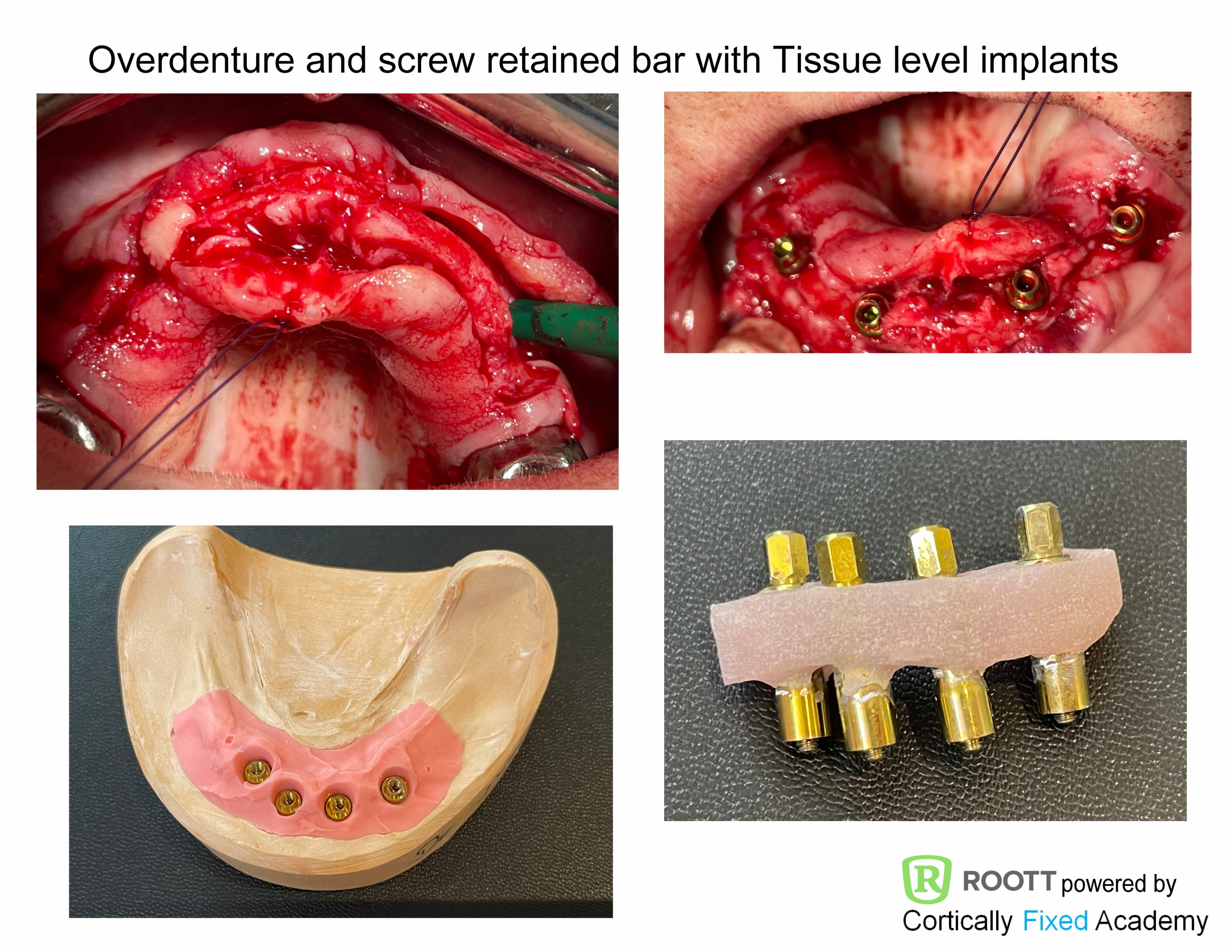 Minimal Invasive